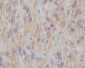 Anti-NGFR/P75 Rabbit Monoclonal Antibody